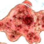 കേരളത്തിൽ വീണ്ടും അമീബിക് മസ്തിഷ്ക ജ്വരം; ആറു വയസുകാരന് ഗുരുതരാവസ്ഥയില്