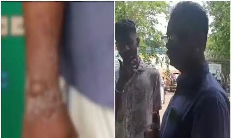 നിലമ്പൂരില് ബൈക്ക് യാത്രികന് സൂര്യാഘാതമേറ്റു