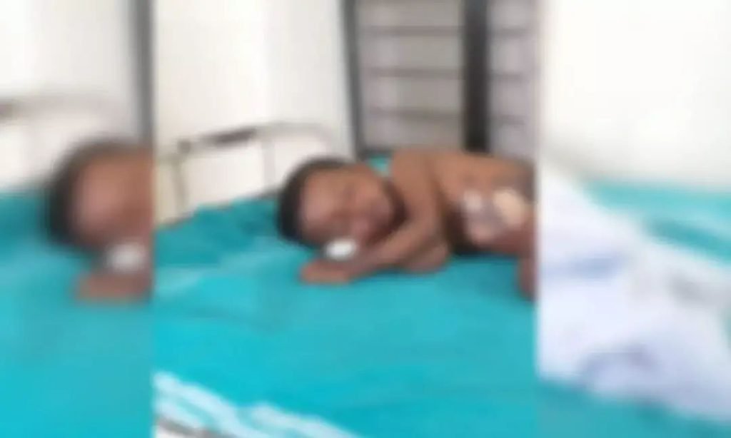 മൂന്ന് വയസുകാരനോട് കൊടും ക്രൂരത; തിളച്ച ചായ ഒഴിച്ച്‌ ദേഹമാസകലം പൊള്ളിച്ചു