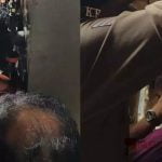 തിരുവനന്തപുരത്ത് വിദ്യാര്‍ഥിനിയുടെ തലമുടി ഷവായി മെഷീനില്‍ കുടുങ്ങി