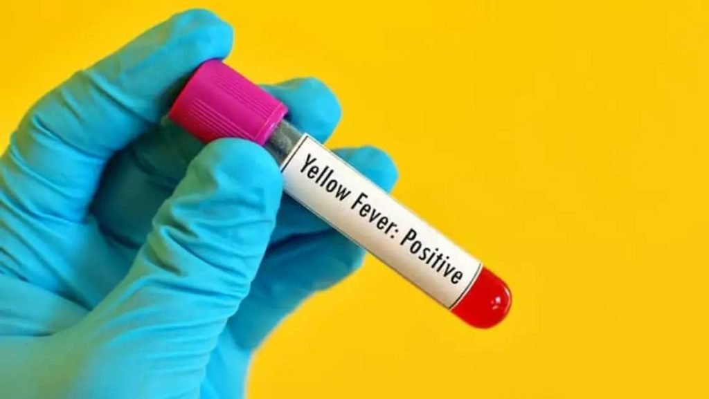 മലപ്പുറത്ത് വിവാഹത്തില്‍ പങ്കെടുത്ത നിരവധി പേര്‍ക്ക് മഞ്ഞപ്പിത്തം സ്ഥീരികരിച്ചു