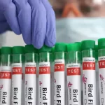 പക്ഷിപ്പനിയിൽ കൂടുതൽ ജാഗ്രത; പ്രത്യേക മാര്‍ഗനിര്‍ദേശങ്ങള്‍ പുറത്തിറക്കി ആരോഗ്യ വകുപ്പ്