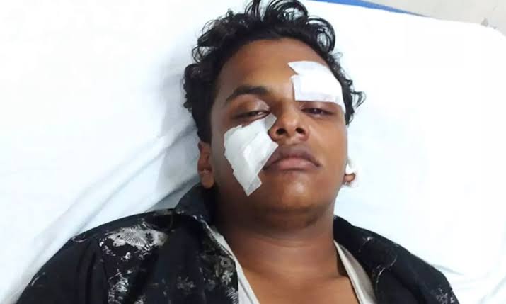 സ്കൂൾ വിദ്യാർഥിയെ മർദിച്ച സംഭവം; അഞ്ച് പേർക്ക് സസ്പെൻഷൻ