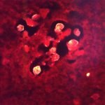 കണ്ണൂര്‍ സ്വദേശിയായ മൂന്നര വയസ്സുകാരന് അമീബിക് മസ്തിഷ്‌കജ്വരം സ്ഥിരീകരിച്ചു