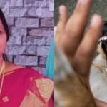 വളര്‍ത്തുനായ മാന്തിയത് കാര്യമാക്കിയില്ല; പേ വിഷബാധയേറ്റ വീട്ടമ്മ മരിച്ചു