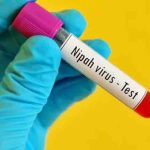 വണ്ടൂരിൽ മരിച്ച ബെംഗളൂരുവിലെ വിദ്യാര്‍ഥിക്ക് നിപ സ്ഥിരീകരിച്ചു; 151 പേർ സമ്പർക്ക പട്ടികയിൽ