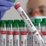 ആലപ്പുഴയില്‍ എംപോക്‌സ് സംശയം; ഒരാള്‍ ആശുപത്രിയില്‍