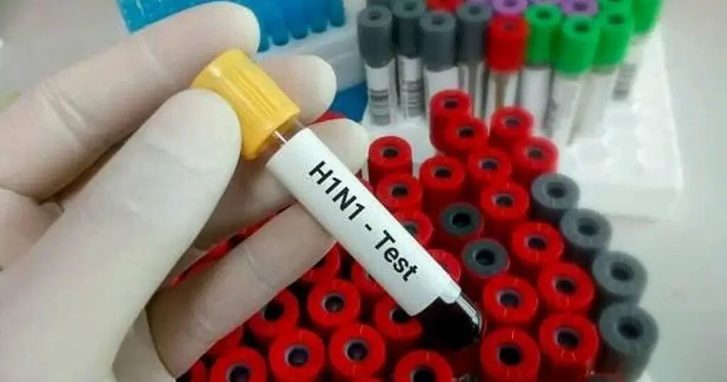 എച്ച്‌1എൻ1 ബാധിച്ച വീട്ടമ്മ മരിച്ചു