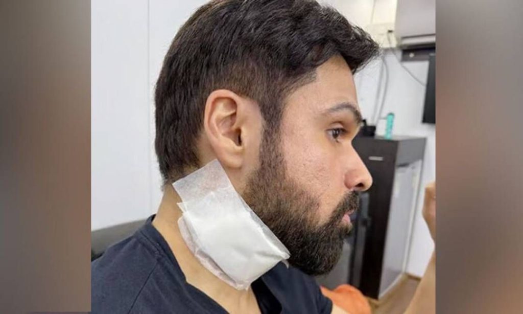 ഷൂട്ടിങ്ങിനിടെ അപകടം; ബോളിവുഡ് താരം ഇമ്രാൻ ഹാഷ്മിക്ക് പരുക്ക്