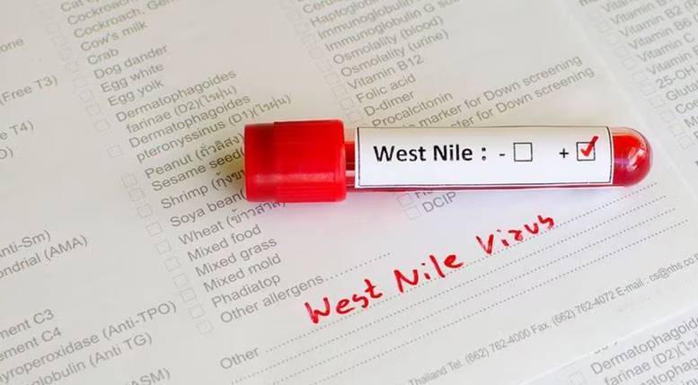 വീണ്ടും വെസ്റ്റ് നൈല്‍; കണ്ണൂരിൽ 19 കാരിക്ക് രോഗം സ്ഥിരീകരിച്ചു