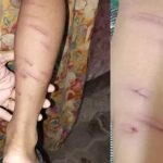 ഡയറി എഴുതാത്തതിന് അഞ്ച് വയസുകാരന് ക്രൂരമര്‍ദ്ദനം; അധ്യാപിക അറസ്റ്റില്‍