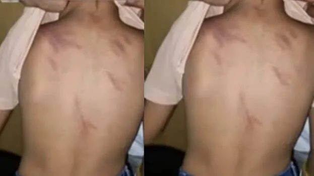 ചോദ്യം ചോദിച്ചതിന് മറുപടി നൽകിയില്ല; എല്കെജി വിദ്യാർഥിക്ക് ക്രൂരമർദനം, അധ്യാപിക അറസ്റ്റില്