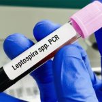 കൊല്ലത്ത് എലിപ്പനി ബാധിച്ച്‌ 45കാരൻ മരിച്ചു