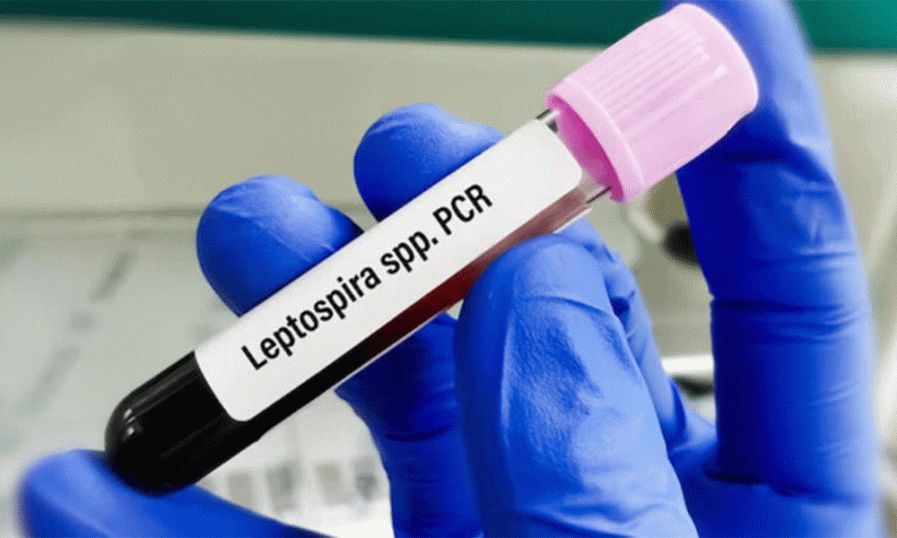 കൊല്ലത്ത് എലിപ്പനി ബാധിച്ച്‌ 45കാരൻ മരിച്ചു