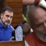 രാഹുല്‍ പിടിച്ചുതള്ളി; ചോരയൊലിപ്പിച്ച്‌ ബിജെപി എംപി