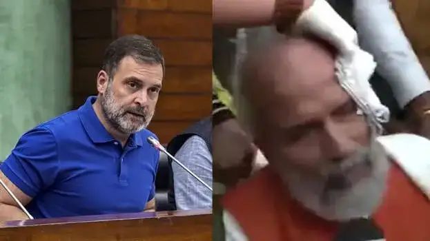 രാഹുല്‍ പിടിച്ചുതള്ളി; ചോരയൊലിപ്പിച്ച്‌ ബിജെപി എംപി