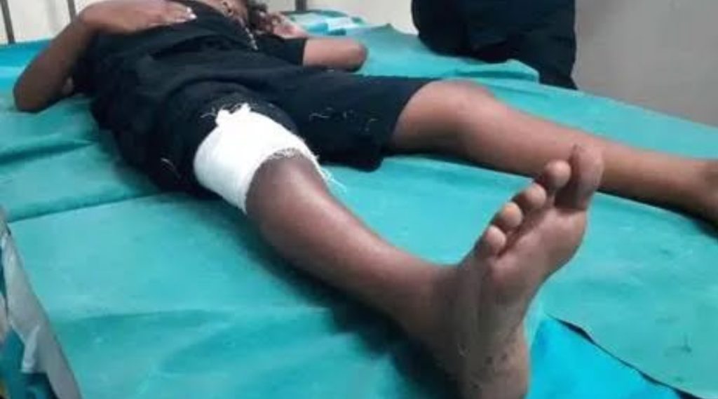 ശബരിമല ദർശനത്തിനെത്തിയ ഒമ്പത് വയസുകാരനെ പന്നി ആക്രമിച്ചു