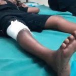 ശബരിമല ദർശനത്തിനെത്തിയ ഒമ്പത് വയസുകാരനെ പന്നി ആക്രമിച്ചു