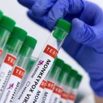 കർണാടകയിൽ എം-പോക്സ് കേസ് സ്ഥിരീകരിച്ചു