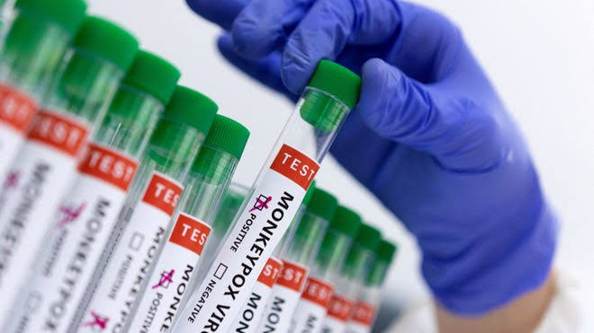 കർണാടകയിൽ എം-പോക്സ് കേസ് സ്ഥിരീകരിച്ചു