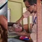 പാഴ്‌സല്‍ വാങ്ങിയ അല്‍ഫാമില്‍ പുഴുക്കള്‍; കോഴിക്കോട് കാറ്ററിംഗ് യൂണിറ്റ് അടച്ചുപൂട്ടി