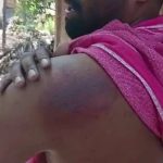 പാലക്കാട് യുവാവിന് സൂര്യാഘാതമേറ്റു