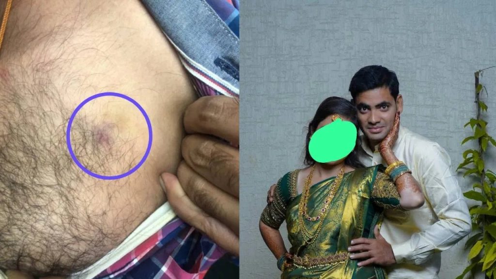 സ്വകാര്യ ഭാഗങ്ങളിൽ ആക്രമിച്ച് കൊലപ്പെടുത്താൻ ശ്രമിച്ചു; ഭാര്യക്കെതിരെ ഗുരുതര ആരോപണവുമായി ടെക്കി യുവാവ്