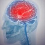 കളമശ്ശേരിയില്‍ രണ്ട് വിദ്യാര്‍ഥികള്‍ക്ക് മസ്തിഷ്ക ജ്വരം സ്ഥിരീകരിച്ചു