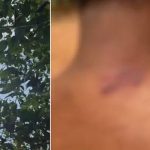 കോഴിക്കോട് കര്‍ഷകന് സൂര്യാഘാതമേറ്റു