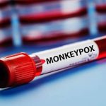 കുരങ്ങുപനി; കർണാടകയിൽ ഈ വർഷത്തെ ആദ്യമരണം റിപ്പോർട്ട്‌ ചെയ്തു