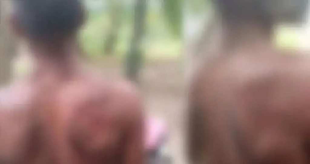 പാലക്കാട് ചുമട്ടു തൊഴിലാളിക്ക് സൂര്യാഘാതമേറ്റു