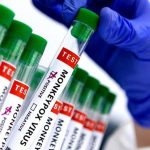 കുരങ്ങുപനി; കർണാടകയിൽ എട്ട് വയസുകാരൻ മരിച്ചു