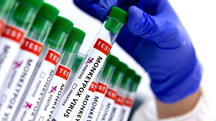 കുരങ്ങുപനി; കർണാടകയിൽ എട്ട് വയസുകാരൻ മരിച്ചു