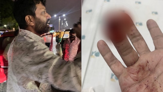 കാറില് വെള്ളം തെറിപ്പിച്ചതിൽ തർക്കം; യുവാവിന്റെ കൈവിരൽ കടിച്ചുമുറിച്ചു